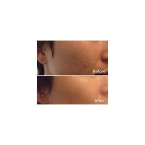 Roseleaf Super Compact Powder